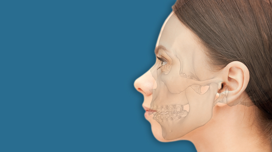 Prognatismo mandibular