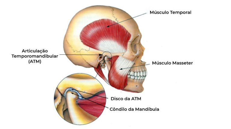 Cirurgia de ATM e Tratamentos Alternativos