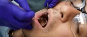 cirurgião bucomaxilofacial